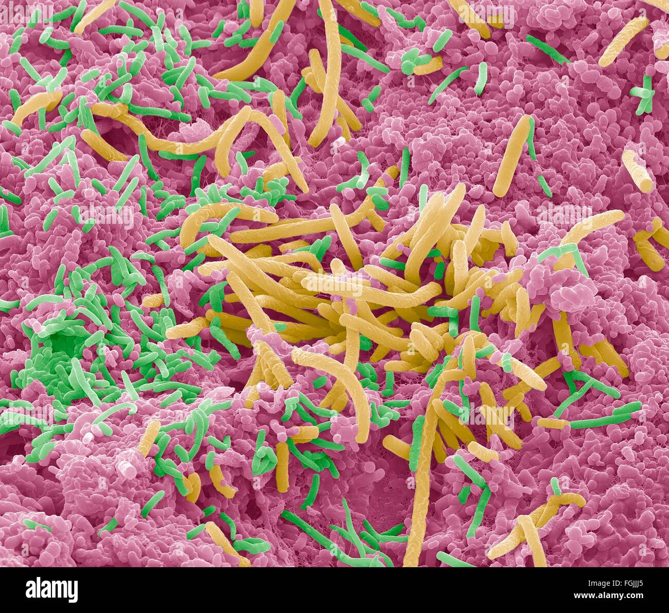 Tongue bacteria. Coloured scanning electron micrograph (SEM) of bacteria on the surface of a human tongue. Large numbers of Stock Photo