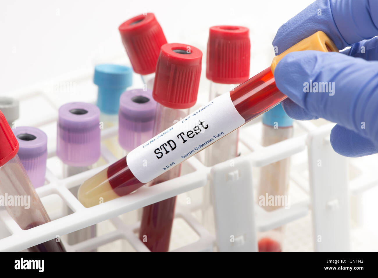 STD test  blood analysis collection tube selected by technician.  Serial number is random, labels and document are fictitious an Stock Photo