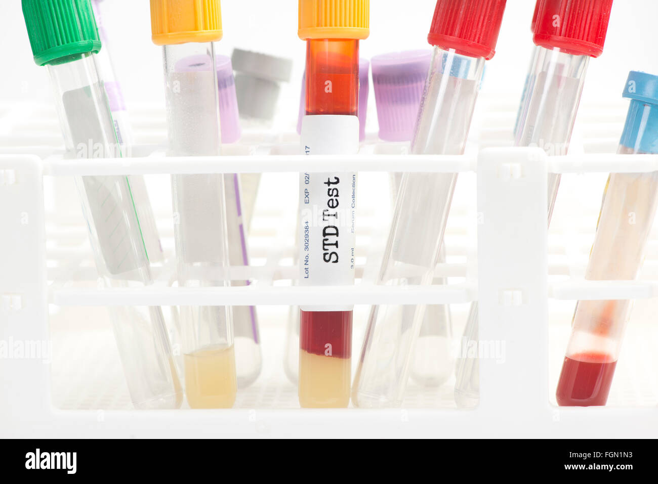 STD blood analysis collection tube with test tube rack.  Labels and document are fictitious and created by the photographer. Stock Photo