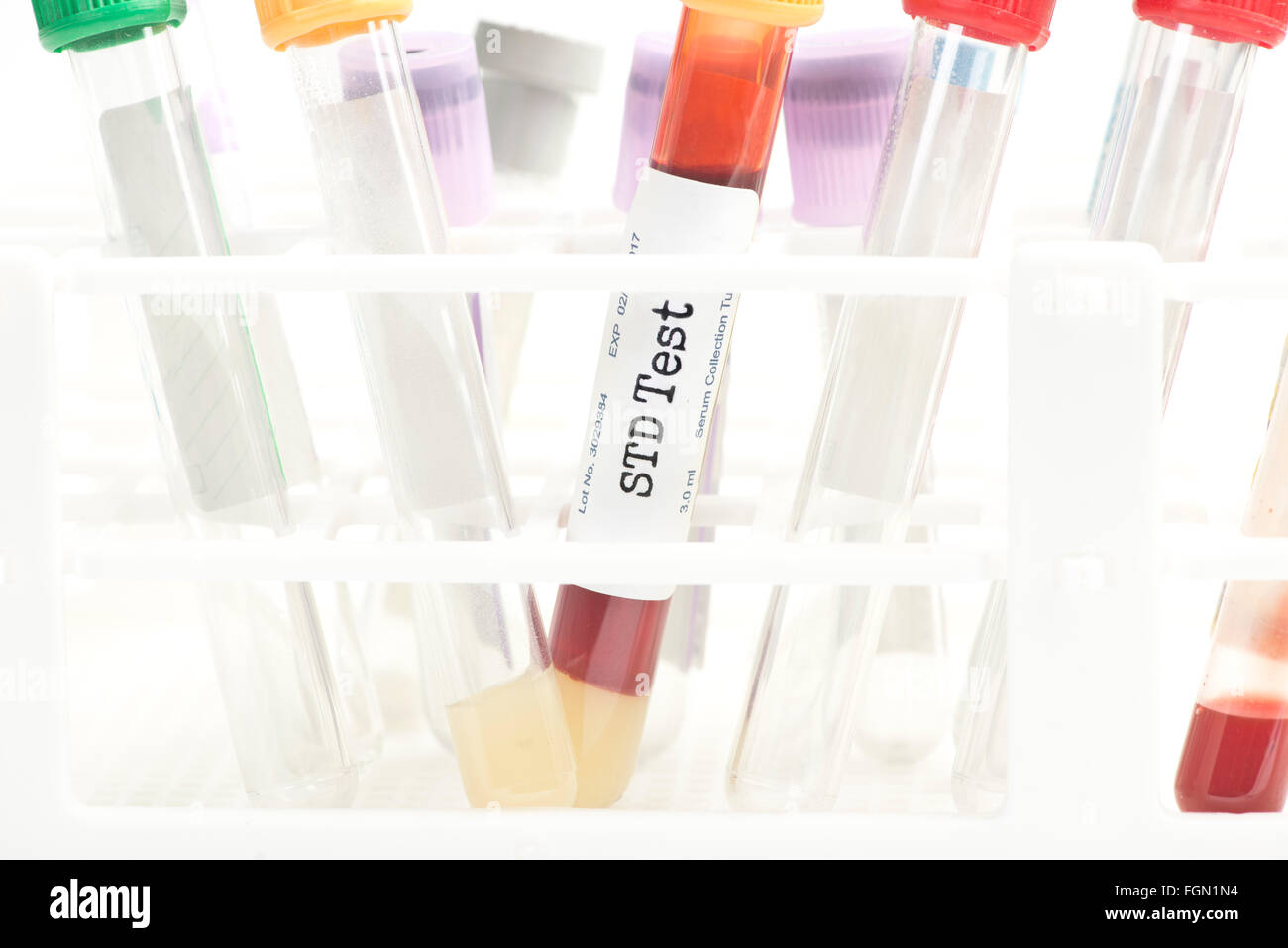 STD blood analysis collection tube with test tube rack.  Labels and document are fictitious and created by the photographer. Stock Photo