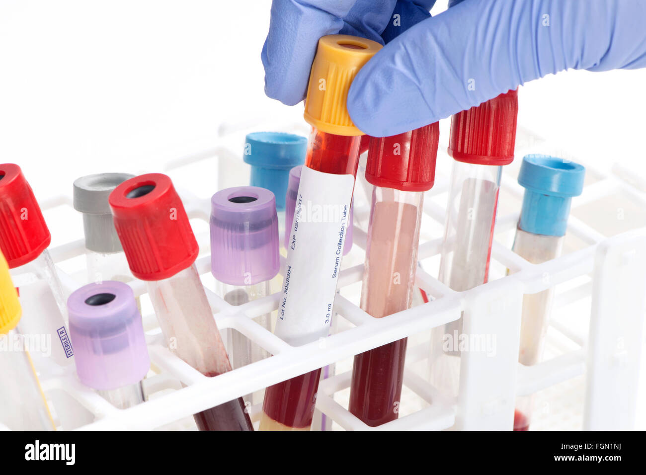 Blood analysis collection tube selected by lab technician. Labels and document are fictitious