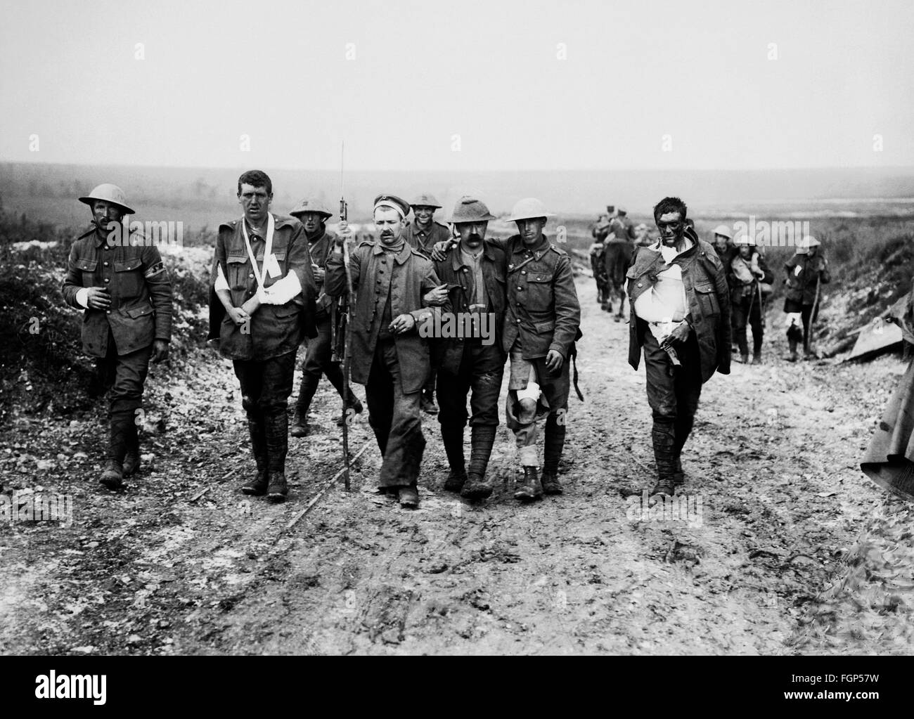 Battle of Verdun 1916 - British Wounded soldiers Stock Photo