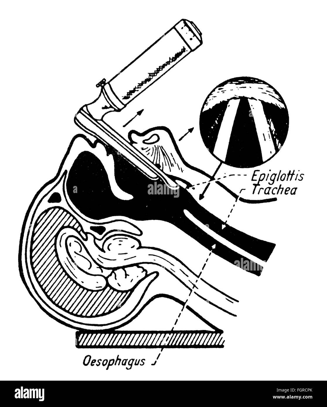 medicine, instruments / equipment, laryngoscope, oral intubation, drawing, out of: E.Rahmer, 'Entwicklung der Modernen Anaesthesie', Stuttgart, 1966, Additional-Rights-Clearences-Not Available Stock Photo