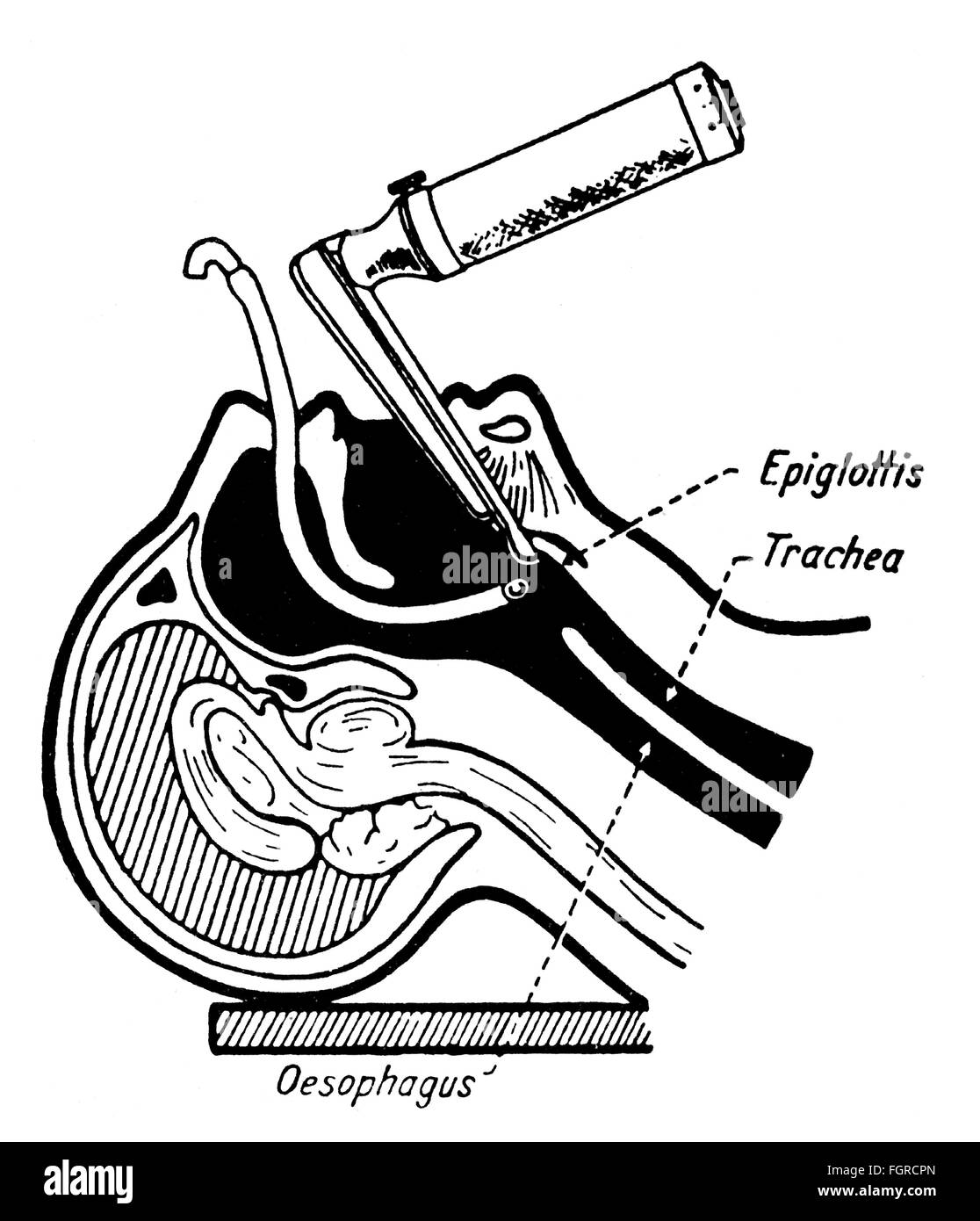 medicine, instruments / equipment, laryngoscope, nasal intubation, drawing, out of: E.Rahmer, 'Entwicklung der Modernen Anaesthesie', Stuttgart, 1966, Additional-Rights-Clearences-Not Available Stock Photo