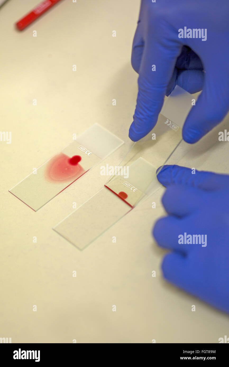 Preparing a blood sample for testing in the pathology laboratory of a hospital. Stock Photo