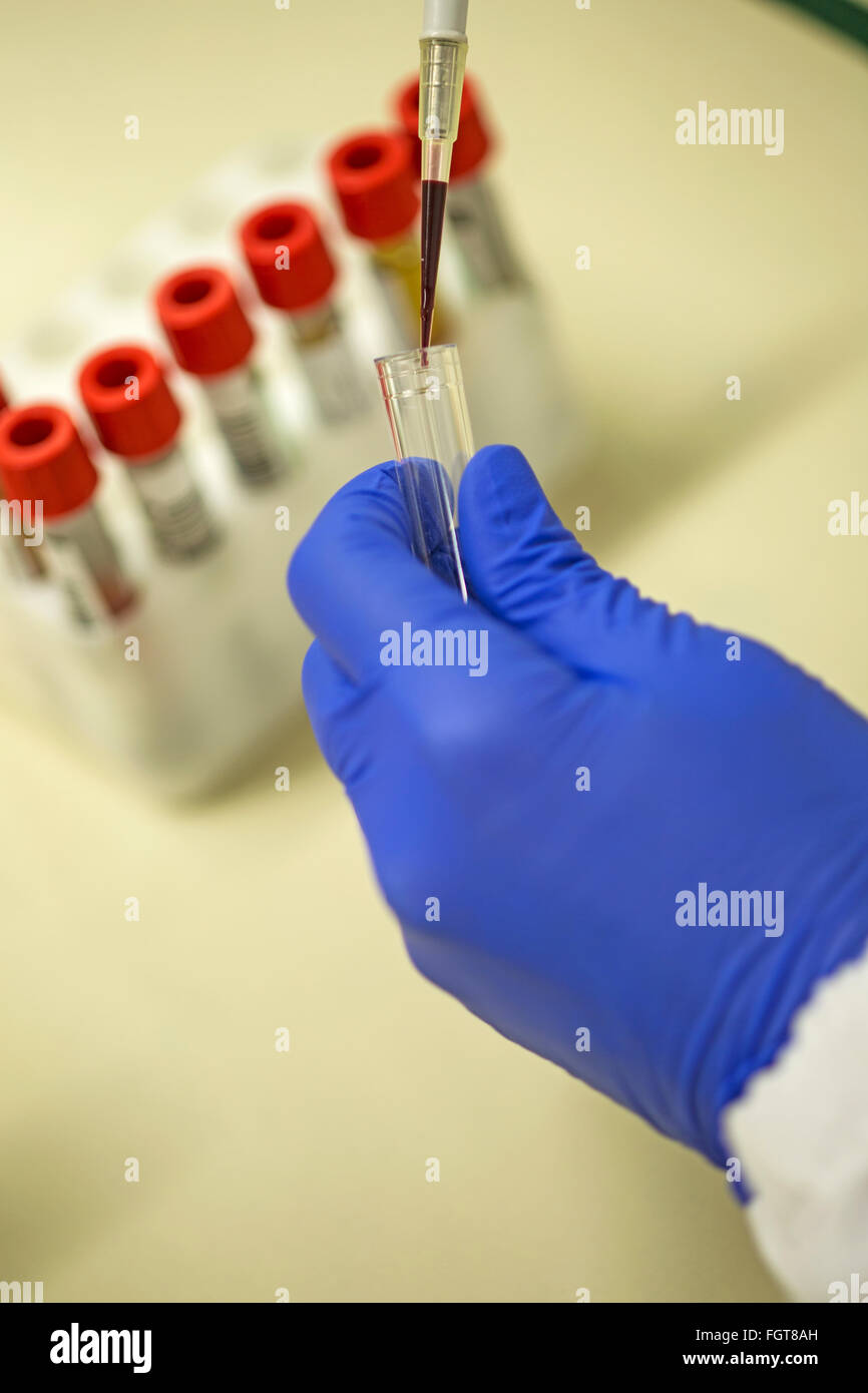 Pipetting blood in a hospital pathology laboratory. Stock Photo