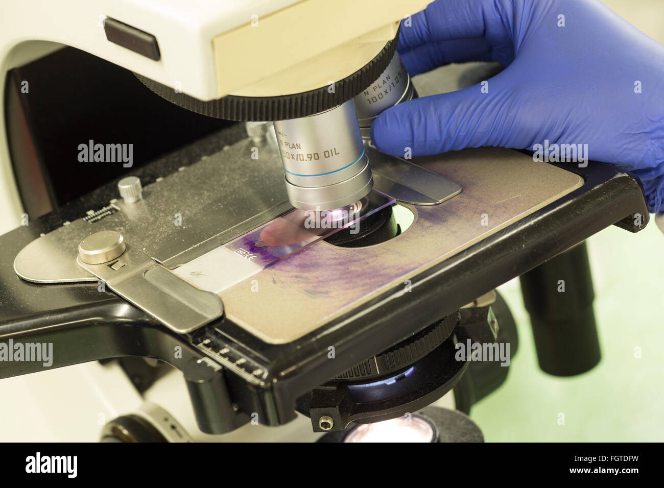 Blood sample being checked under a microscope in a hospital pathology laboratory. Stock Photo