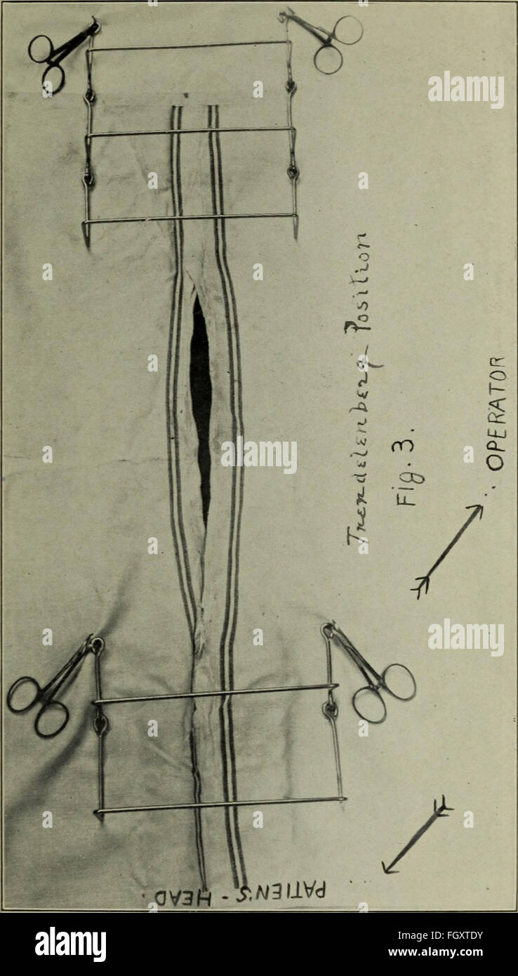 Transaction Surgery The 1920 Transactions of the Southern Surgical and Gynecological ...