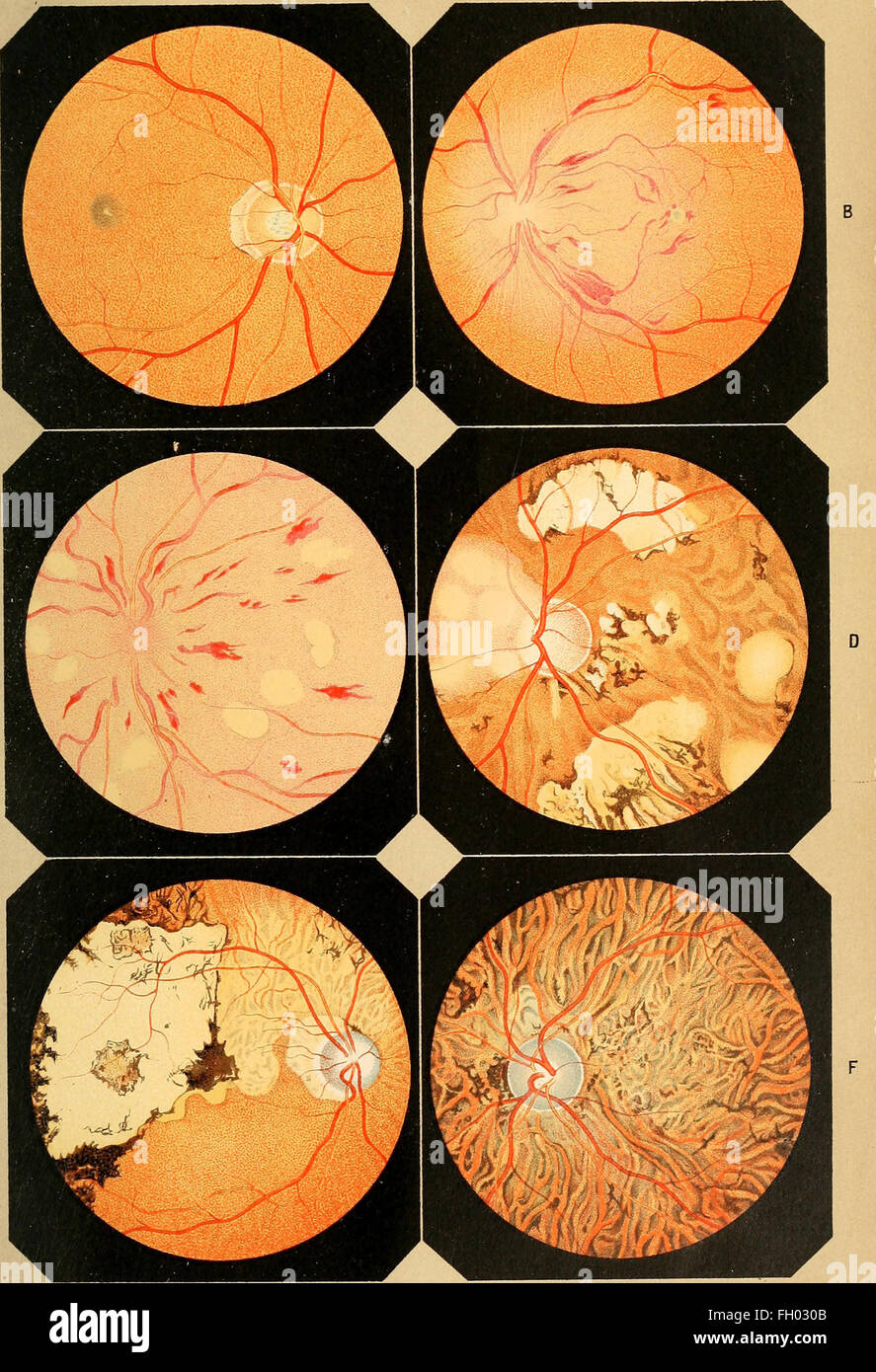 Lehrbuch der praktischen augenheilkunde (1870) Stock Photo