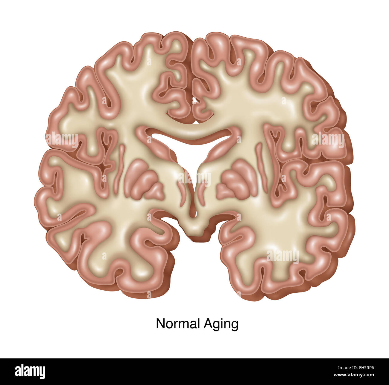 Normal Aging Brain Stock Photo - Alamy