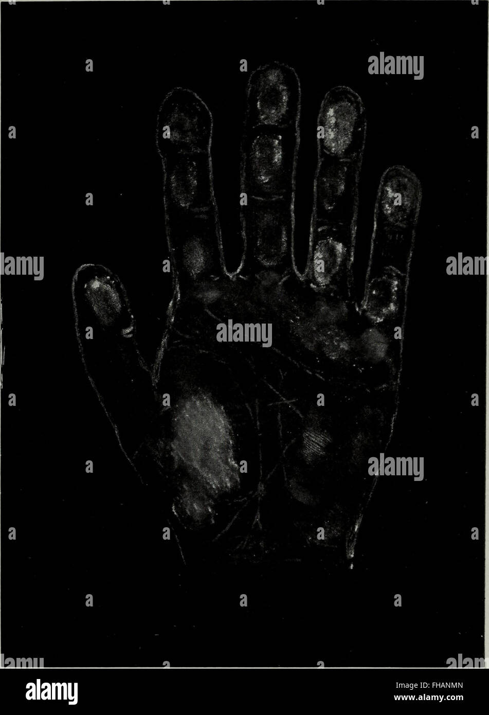 Perin's Science of Palmistry, published in 1902, is a comprehensive and ...
