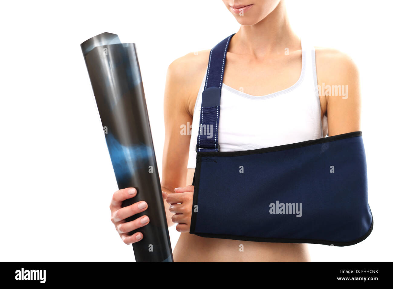 A woman with a broken arm in a sling holding a hand a radiograph. Hand in a sling Stock Photo