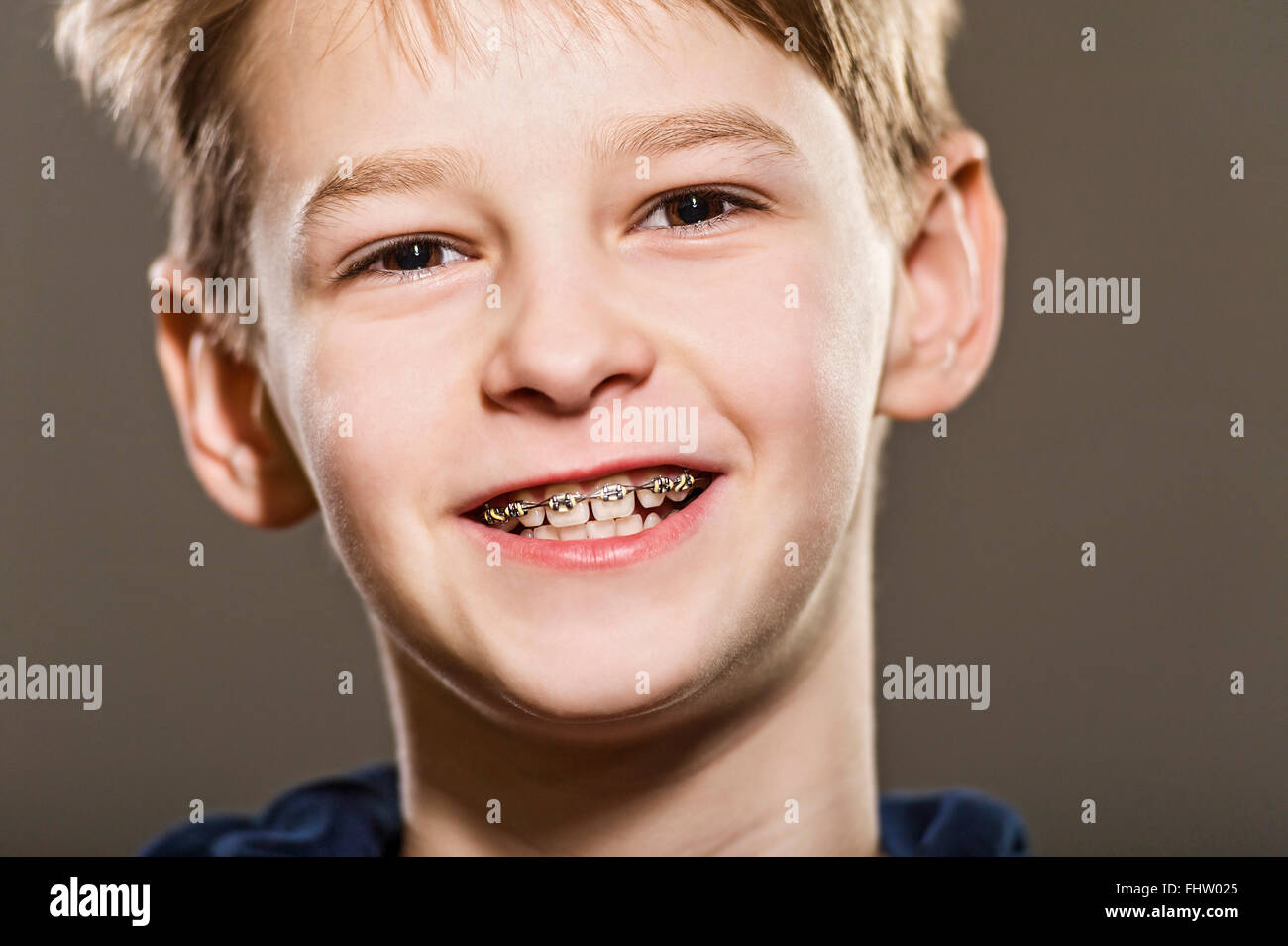 studio portrait of white boy with braces Stock Photo