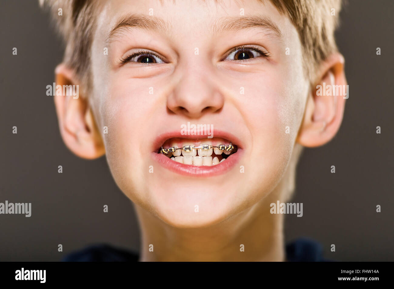 studio portrait of white boy with braces Stock Photo