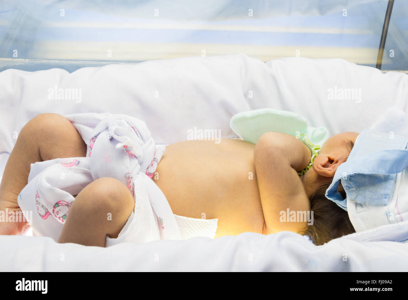 Neonatal jaundice. Newborn was treated by Phototherapy ( Blue light neon at upper and lower side of newborn ) Stock Photo