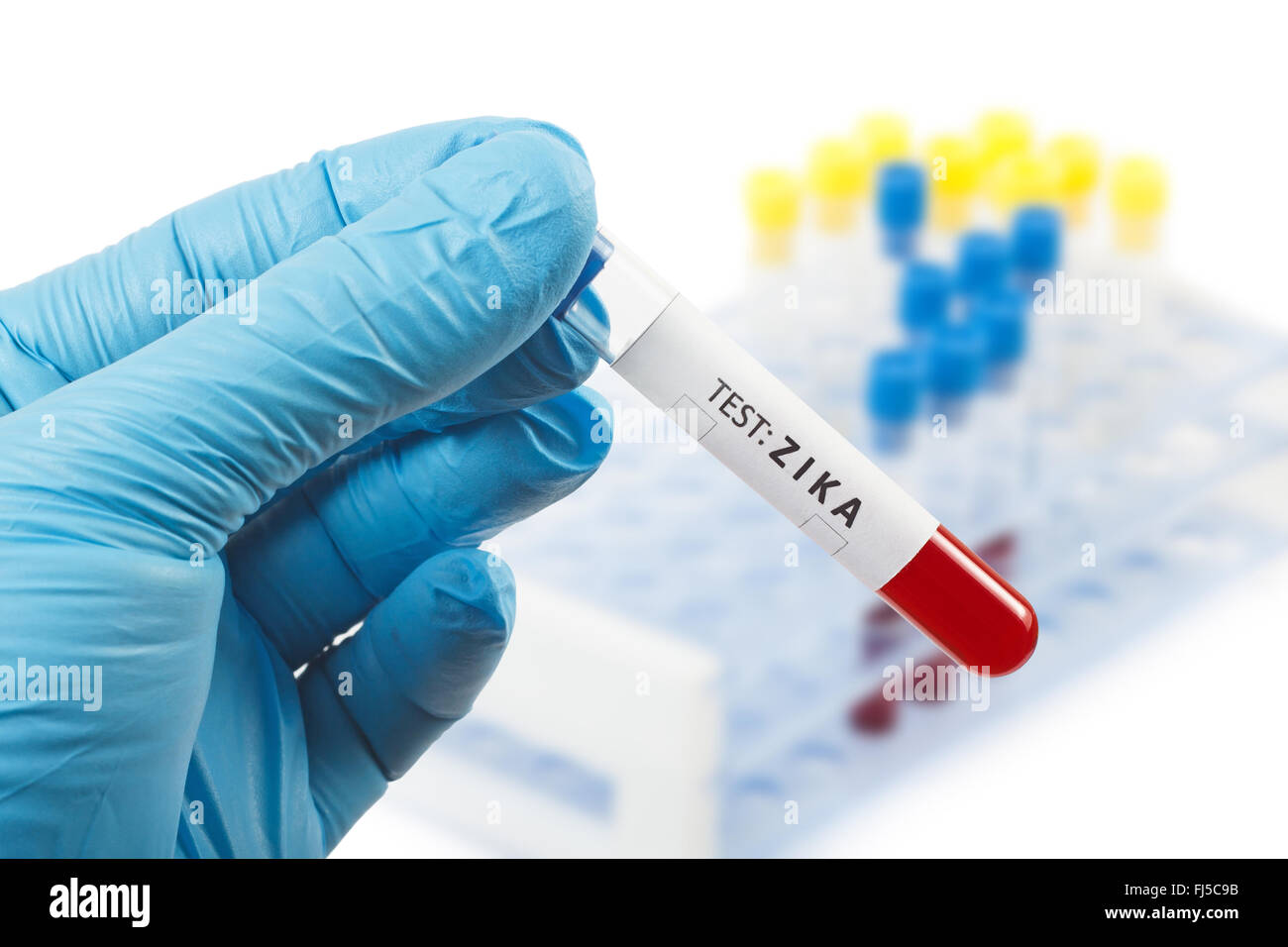 Zika virus test, blood sample Stock Photo