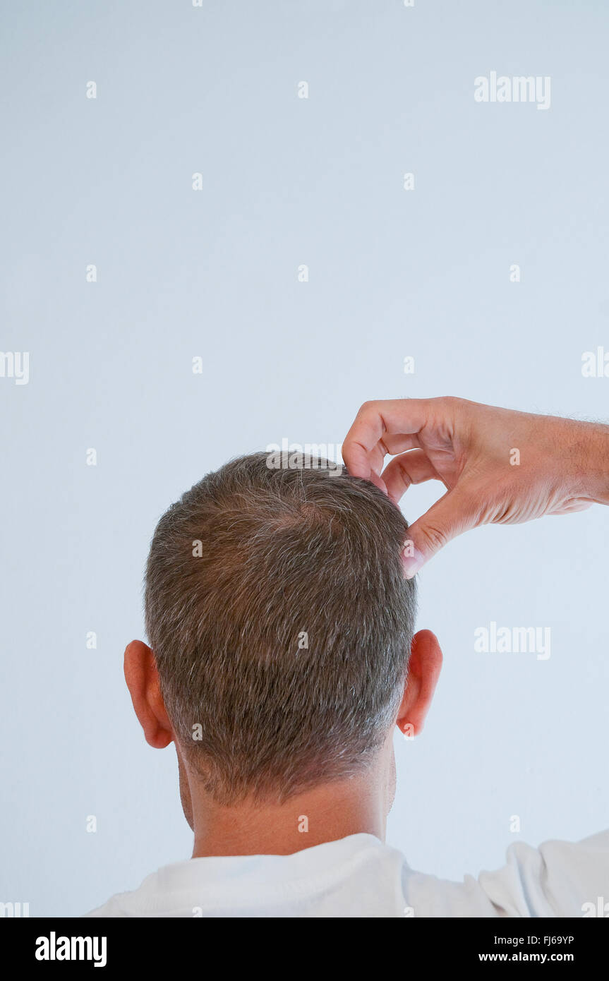 Man scratching his head. Close view. Stock Photo