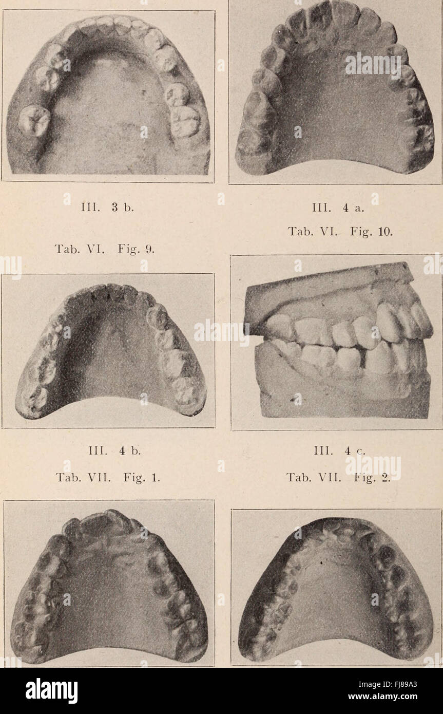 Dental review; devoted to the advancement of dentistry. (1901 Stock