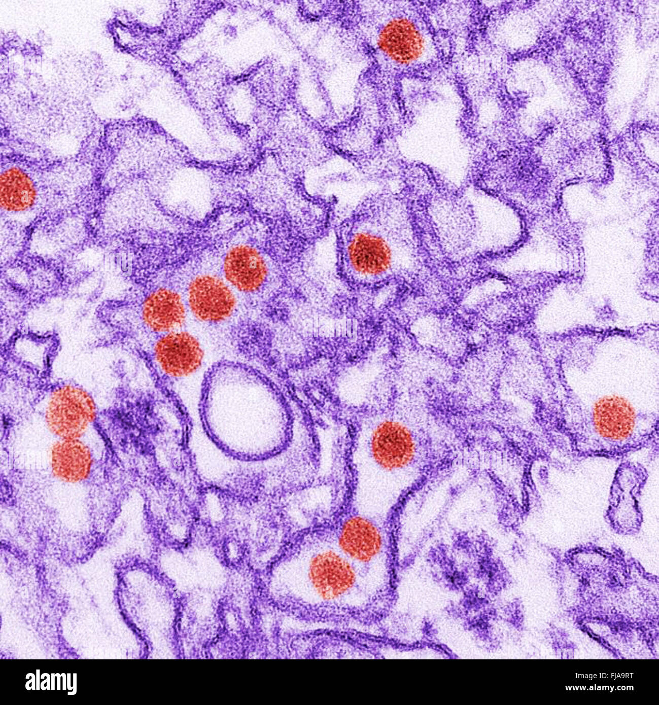 This is a digitally-colorized transmission electron micrograph (TEM) of Zika virus, which is a member of the family Flaviviridae. Virus particles, here colored red, are 40 nm in diameter, with an outer envelope, and an inner dense core. The image was created by CDC/ Cynthia Goldsmith Stock Photo