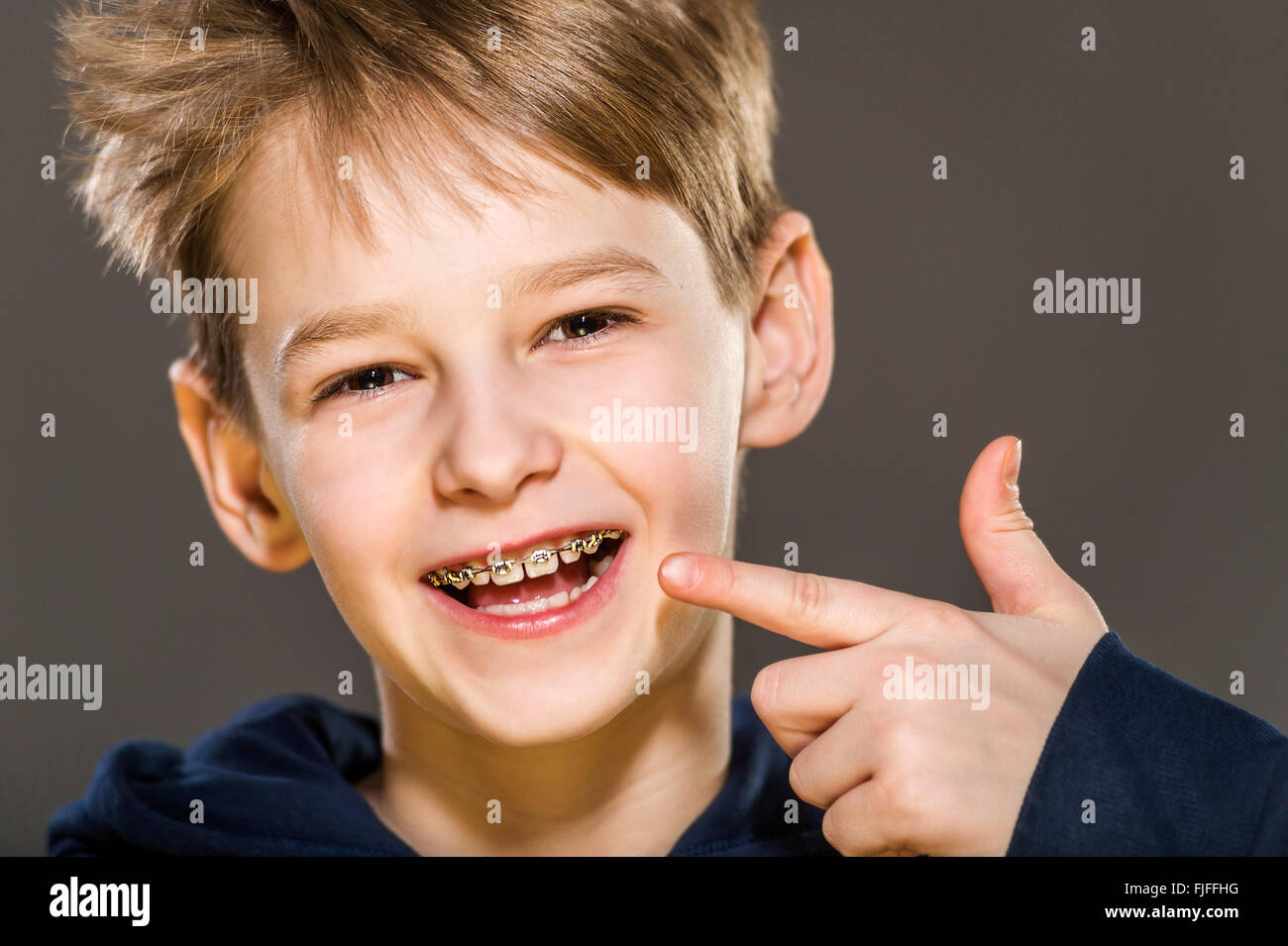 School child wears braces hires stock photography and images Alamy