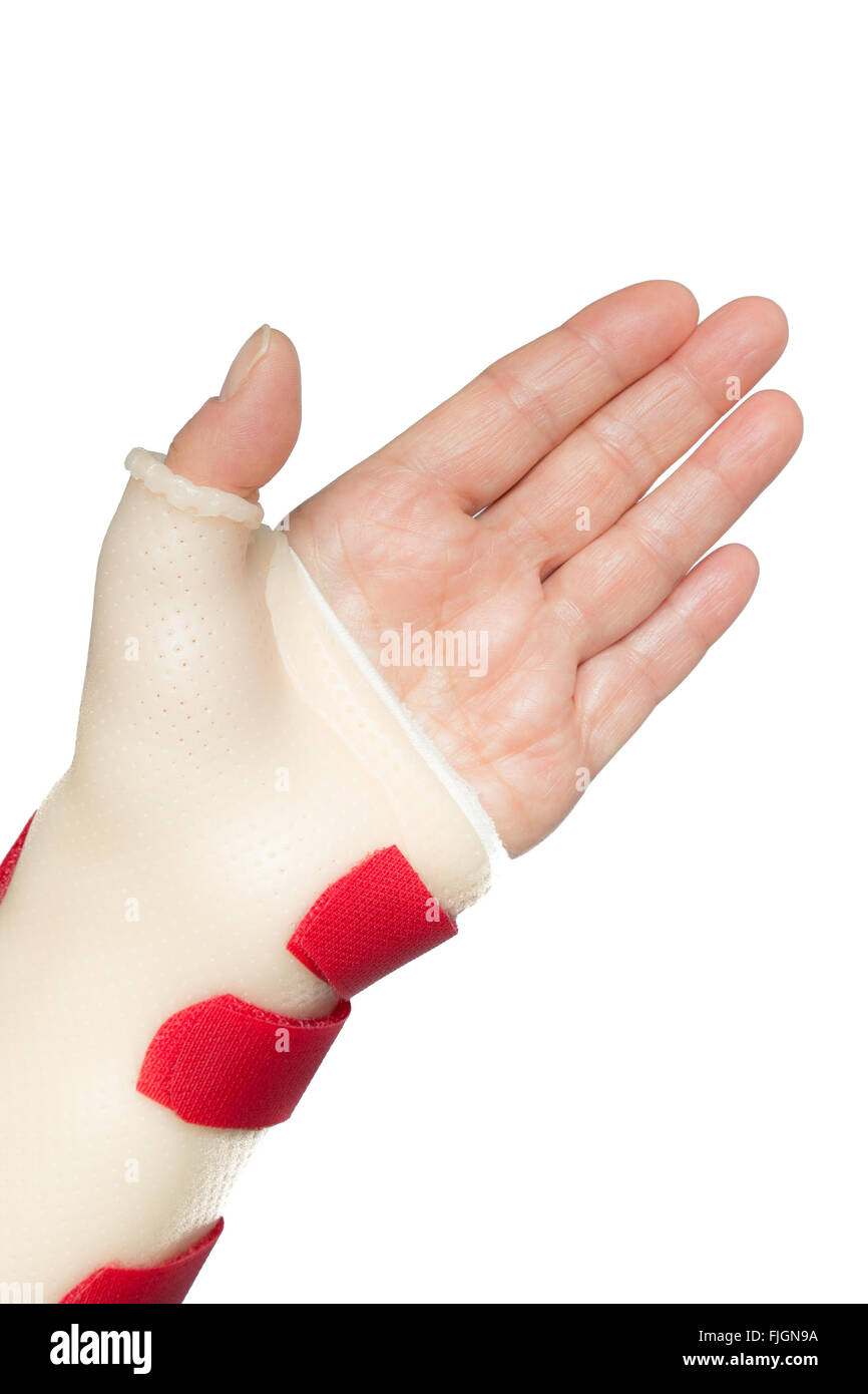 Hand splint hires stock photography and images Alamy