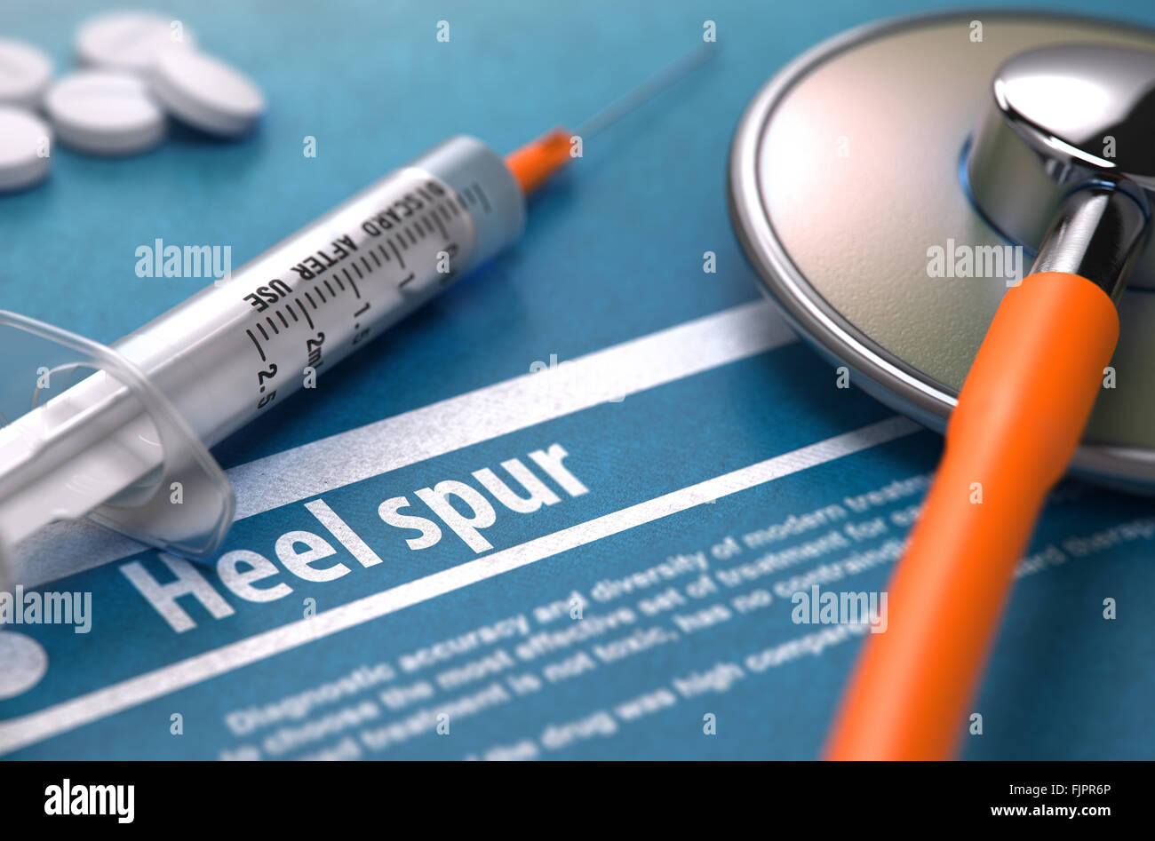 Bone spur hires stock photography and images Alamy