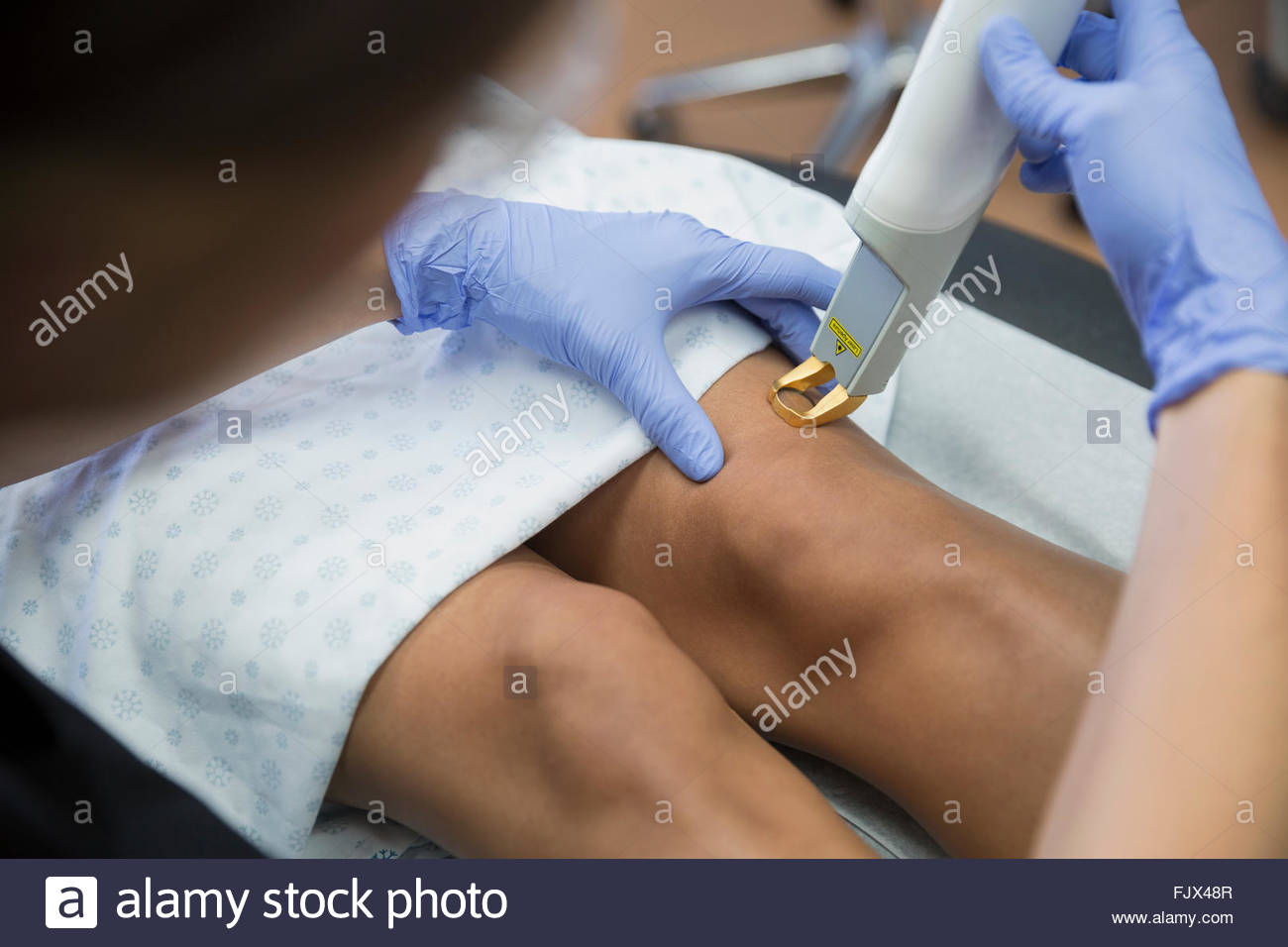 Aesthetic technician treating varicose veins on womans leg Stock Photo