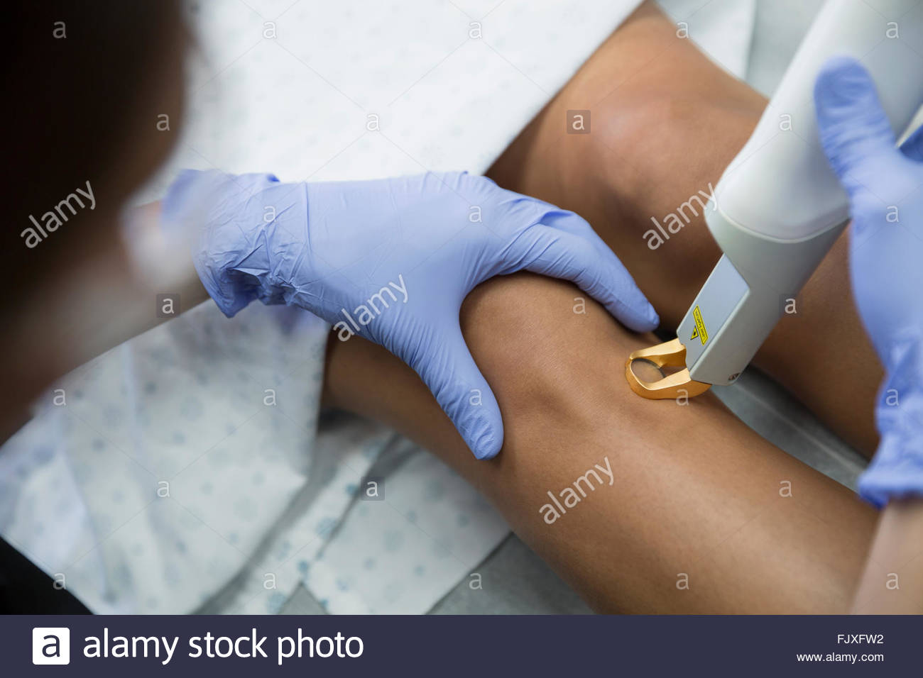 Aesthetic technician treating varicose veins on womans leg Stock Photo