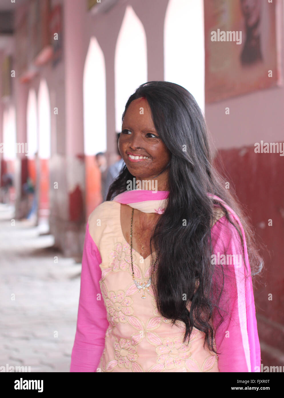 Lucknow, India. 01st Mar, 2016. Model Laxmi Saa pictured in Lucknow, India, 01 March 2016. After becoming victim to an acid attack, she did not leave her home for years but has since fought her way back to normal life. Today, Laxmi is the face of a fashion campaign, talk show host and serves as an inspiration to many other people. Photo: DOREEN FIEDLER/dpa - NO WIRE SERVICE -/dpa/Alamy Live News Stock Photo