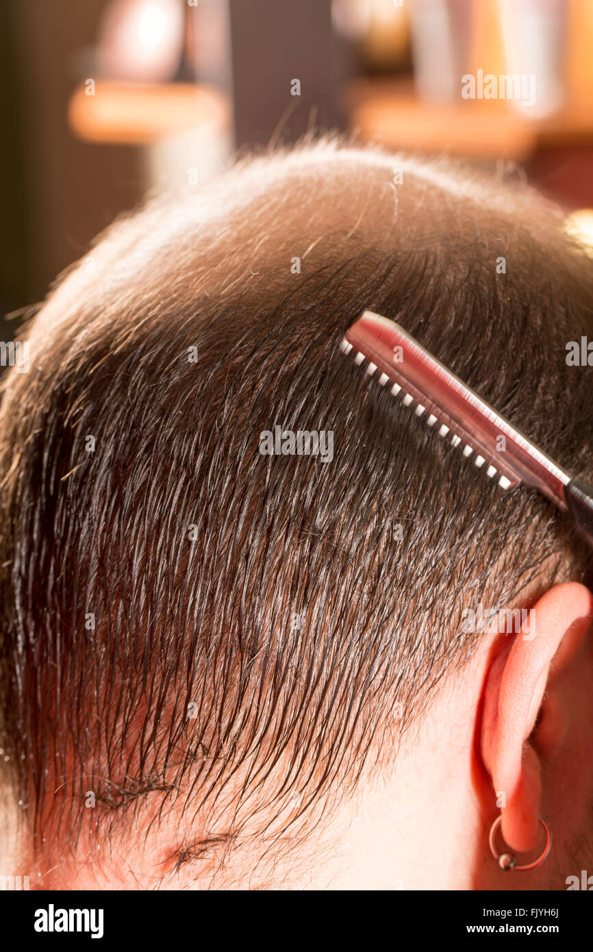 Baldness alopecia or hair loss haircare Stock Photo