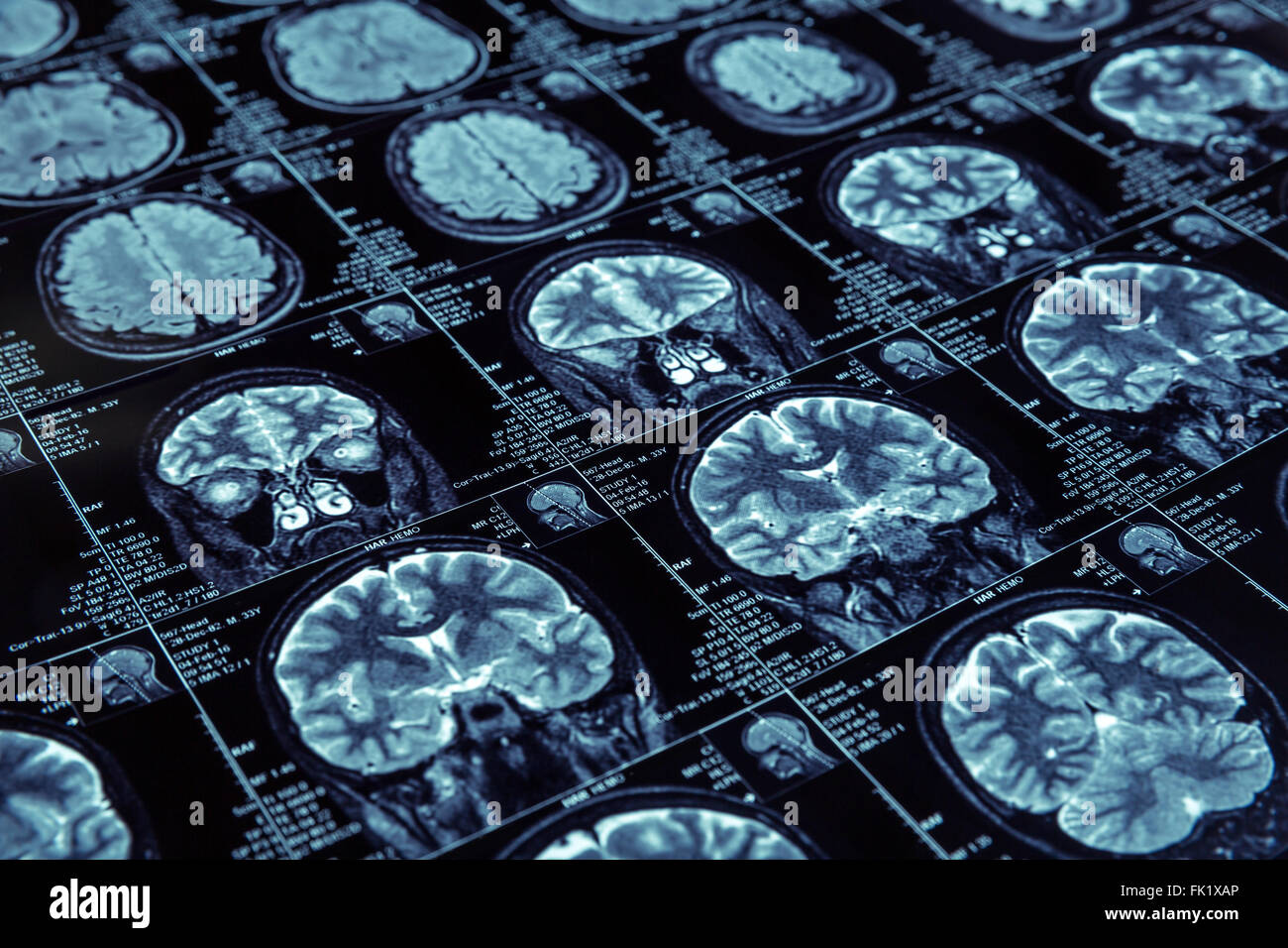 resonance imaging Stock Photo Alamy