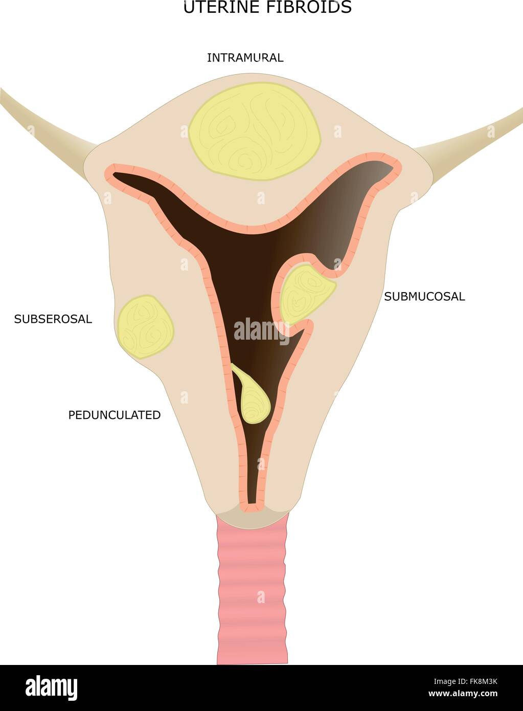 Medicine uterine Stock Vector Images - Alamy