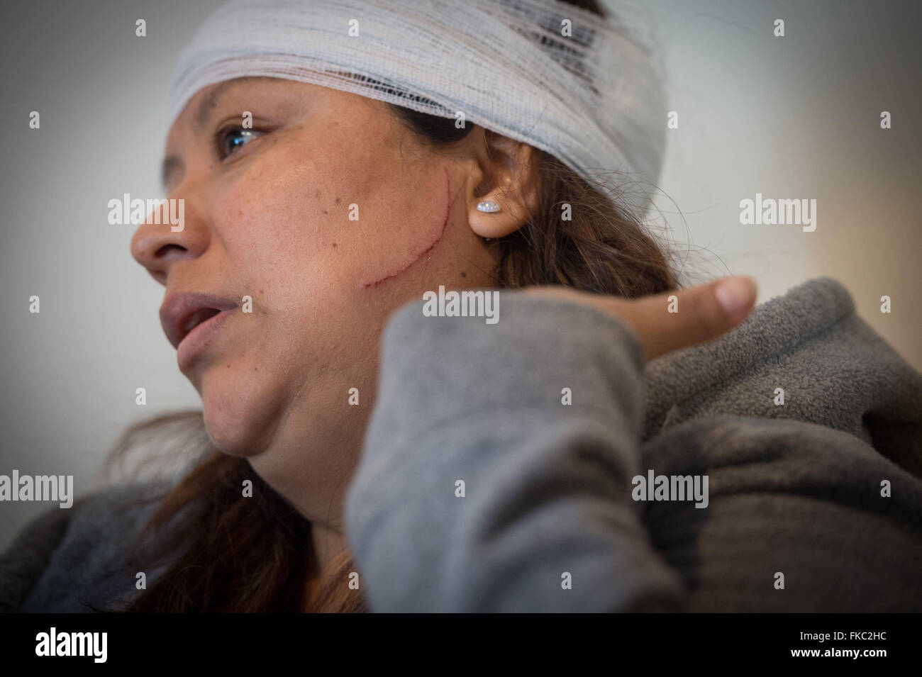 New York, NY, USA. 7th Mar, 2016. Slashing victim BERTA CARPIO describes being attacked following yesterday's violent rampage in Astoria by James Patrick Dillon, who fatally stabbed a man, slashed a woman, set a homeless man on fire and injured two police officers, Monday, March, 7, 2016. Credit:  Bryan Smith/ZUMA Wire/Alamy Live News Stock Photo