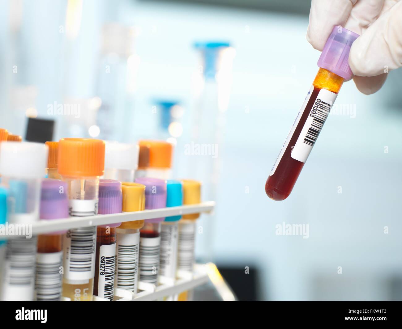 Blood laboratory examination hires stock photography and images Alamy