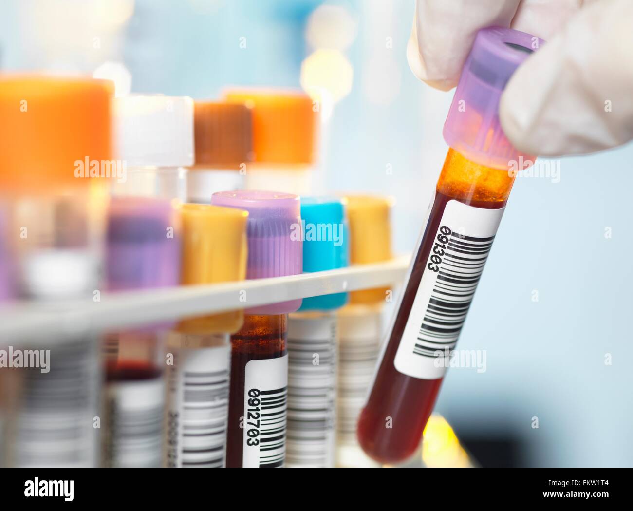 Blood vial barcode hires stock photography and images Alamy