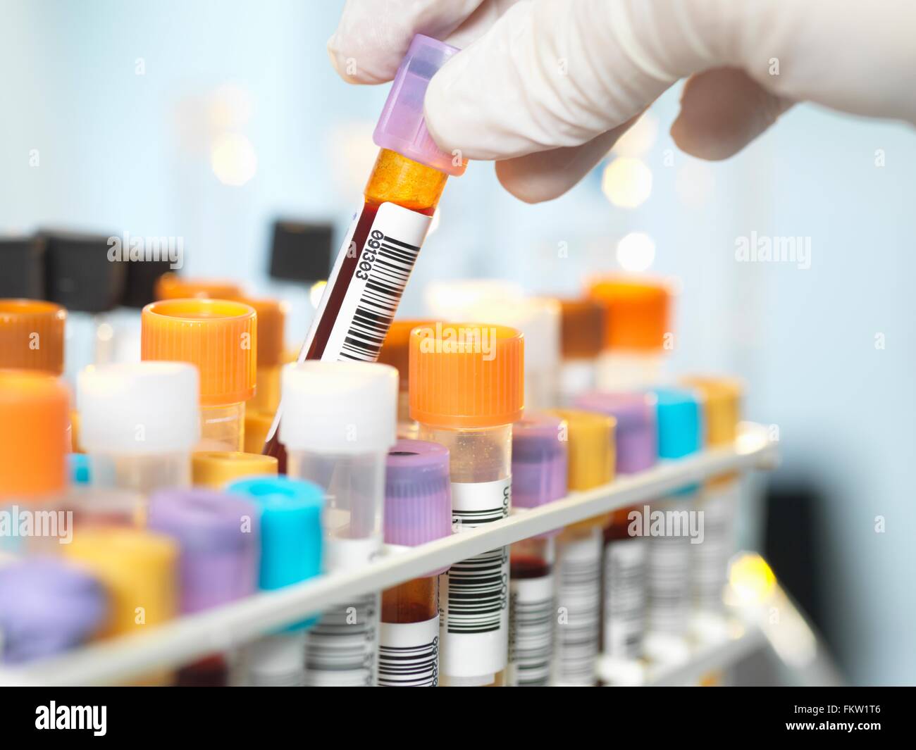 Laboratory technician preparing blood sample for medical testing in laboratory Stock Photo