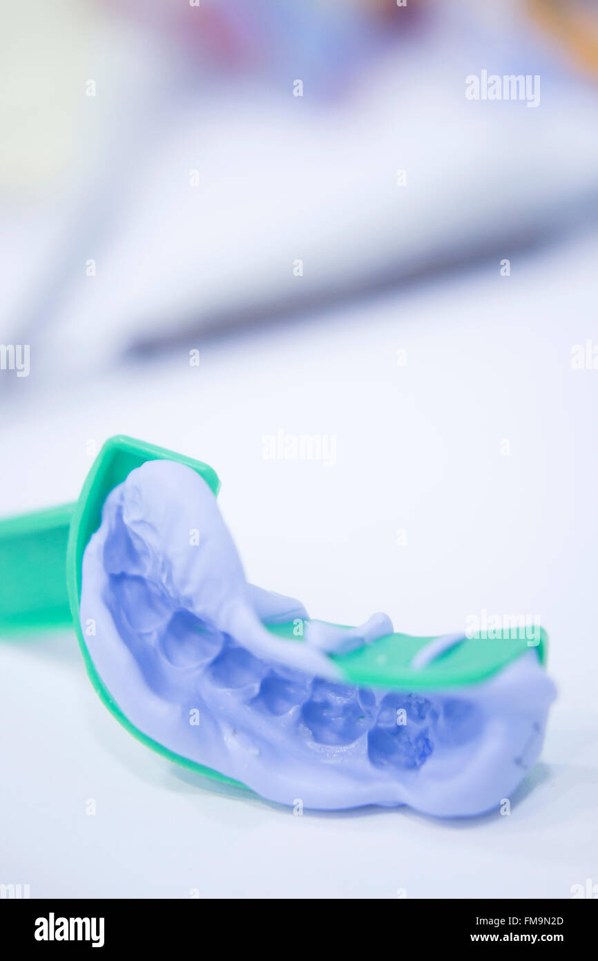 Dental mold dental impression plate in dentist's clinic Stock Photo Alamy