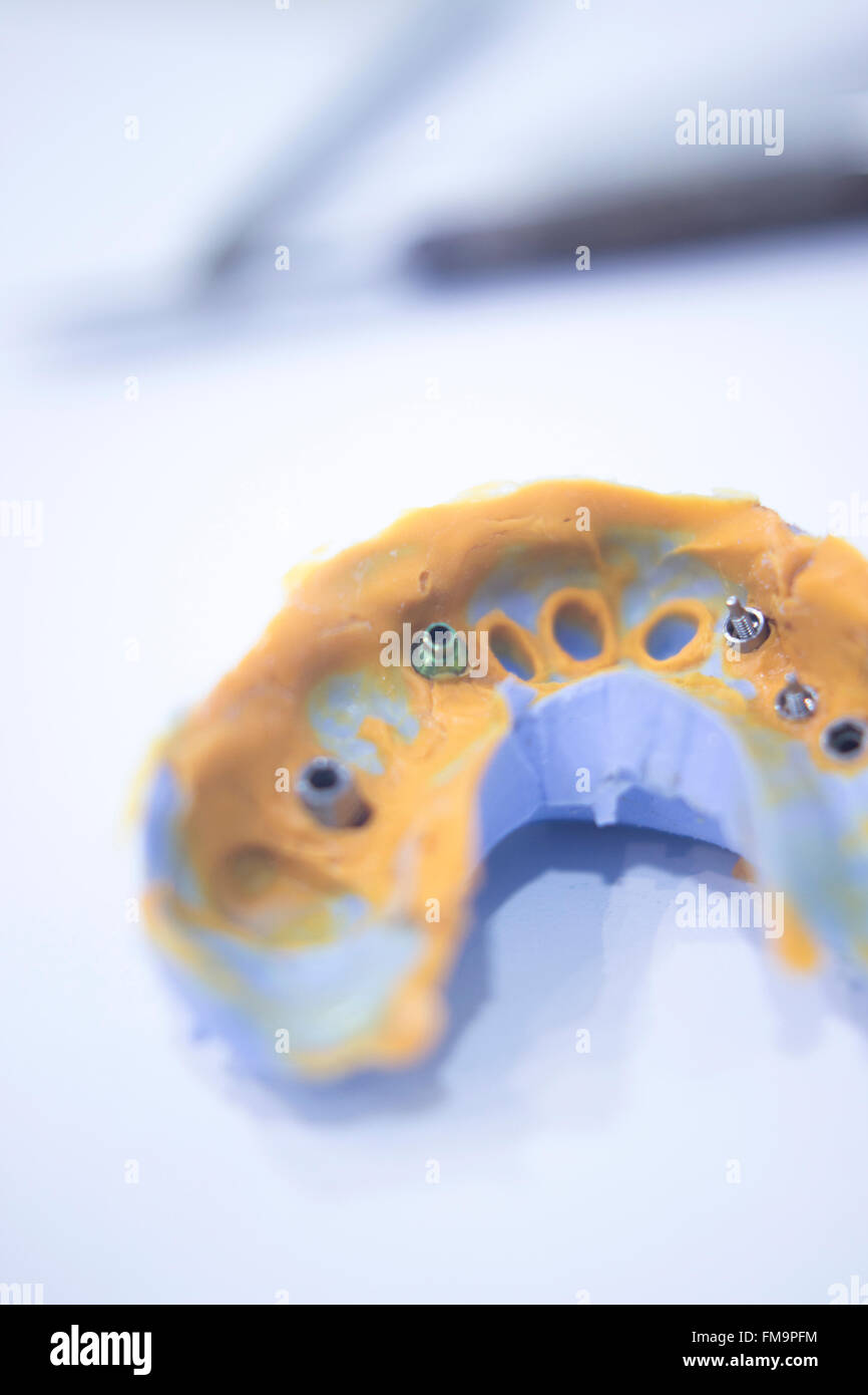 Dental mold dental impression plate in dentist's clinic Stock Photo Alamy