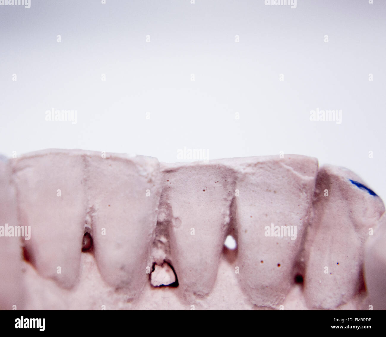 Dental prosthetics clay tooth mold in dentists laboratory photo Stock