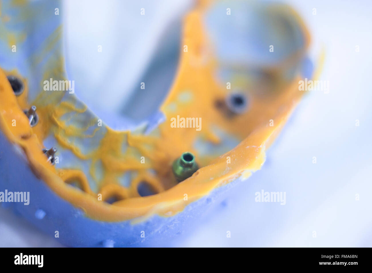 Dental mold dental impression plate in dentist's clinic Stock Photo Alamy