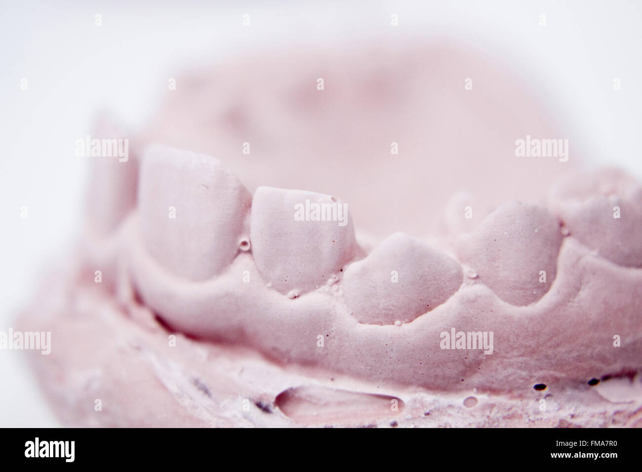 Dental prosthetics clay tooth mold in dentists laboratory photo Stock