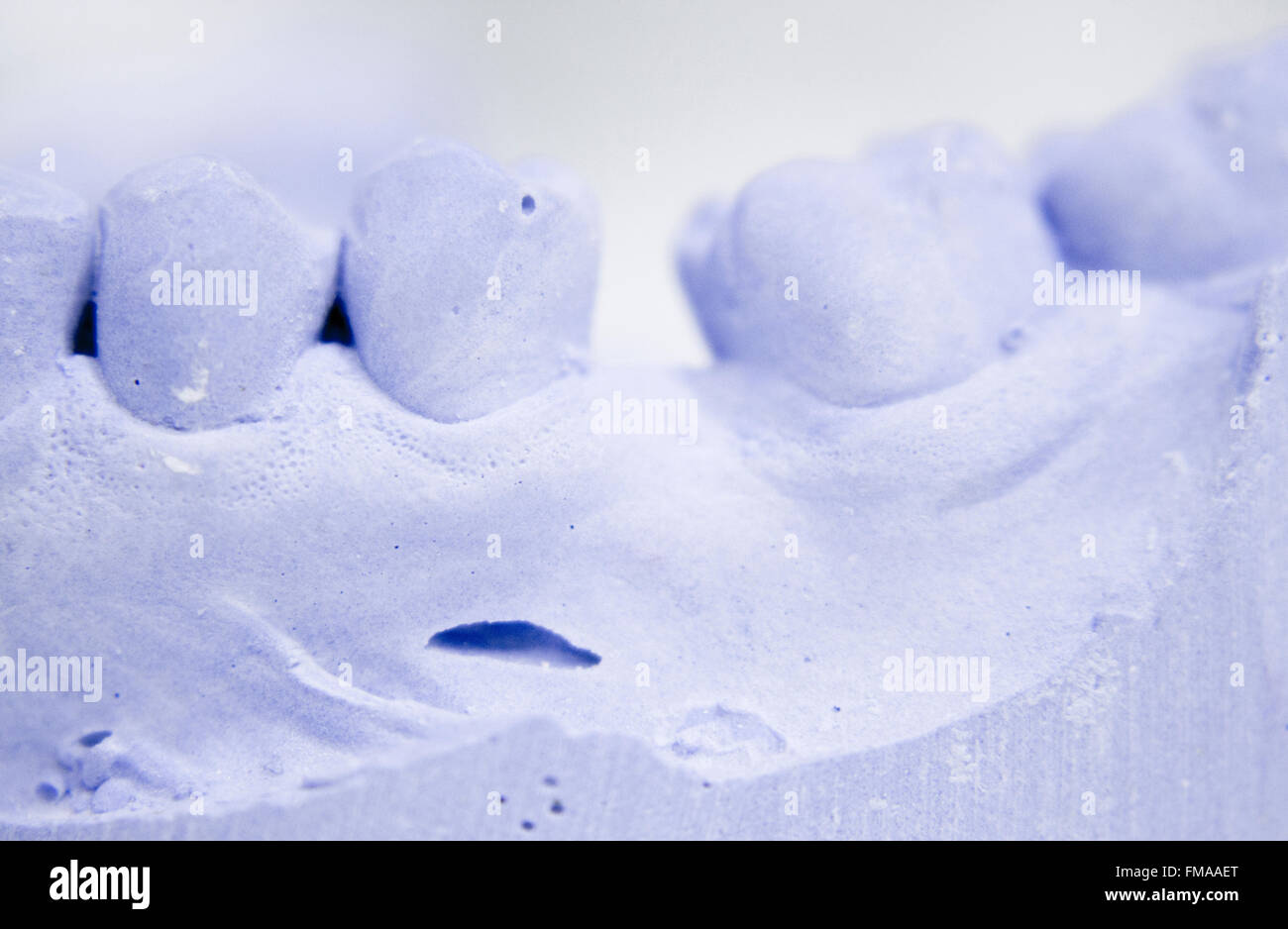 Dental prosthetics clay tooth mold in dentists laboratory photo Stock