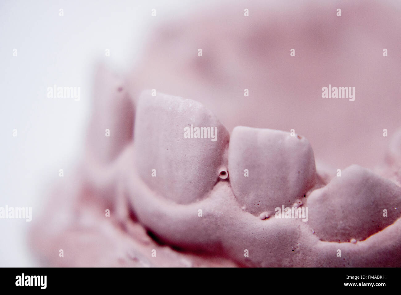 Dental prosthetics clay tooth mold in dentists laboratory photo Stock