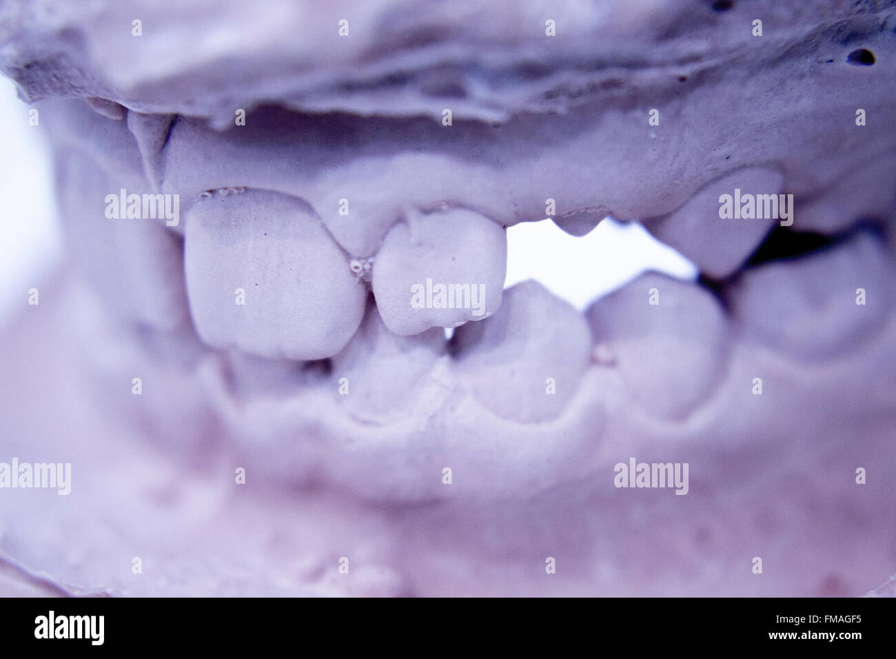 Dental prosthetics clay tooth mold in dentists laboratory photo Stock