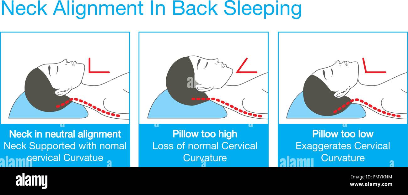 Neck posture while sleeping. женщина спит на спине. Back sleep перевод. Sleep position. Back sleep перевод.