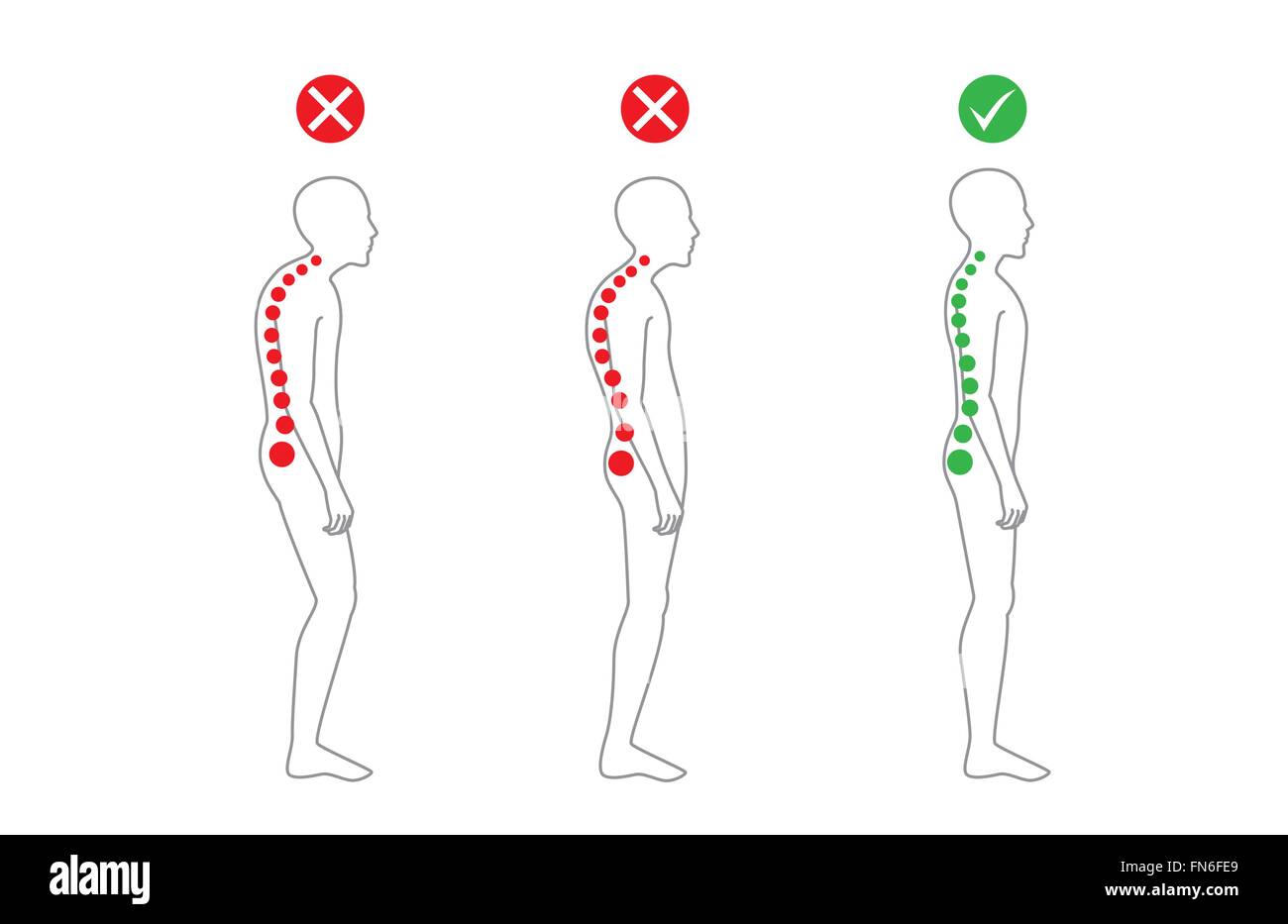 https://c8.alamy.com/comp/FN6FE9/correct-alignment-of-body-in-standing-posture-FN6FE9.jpg
