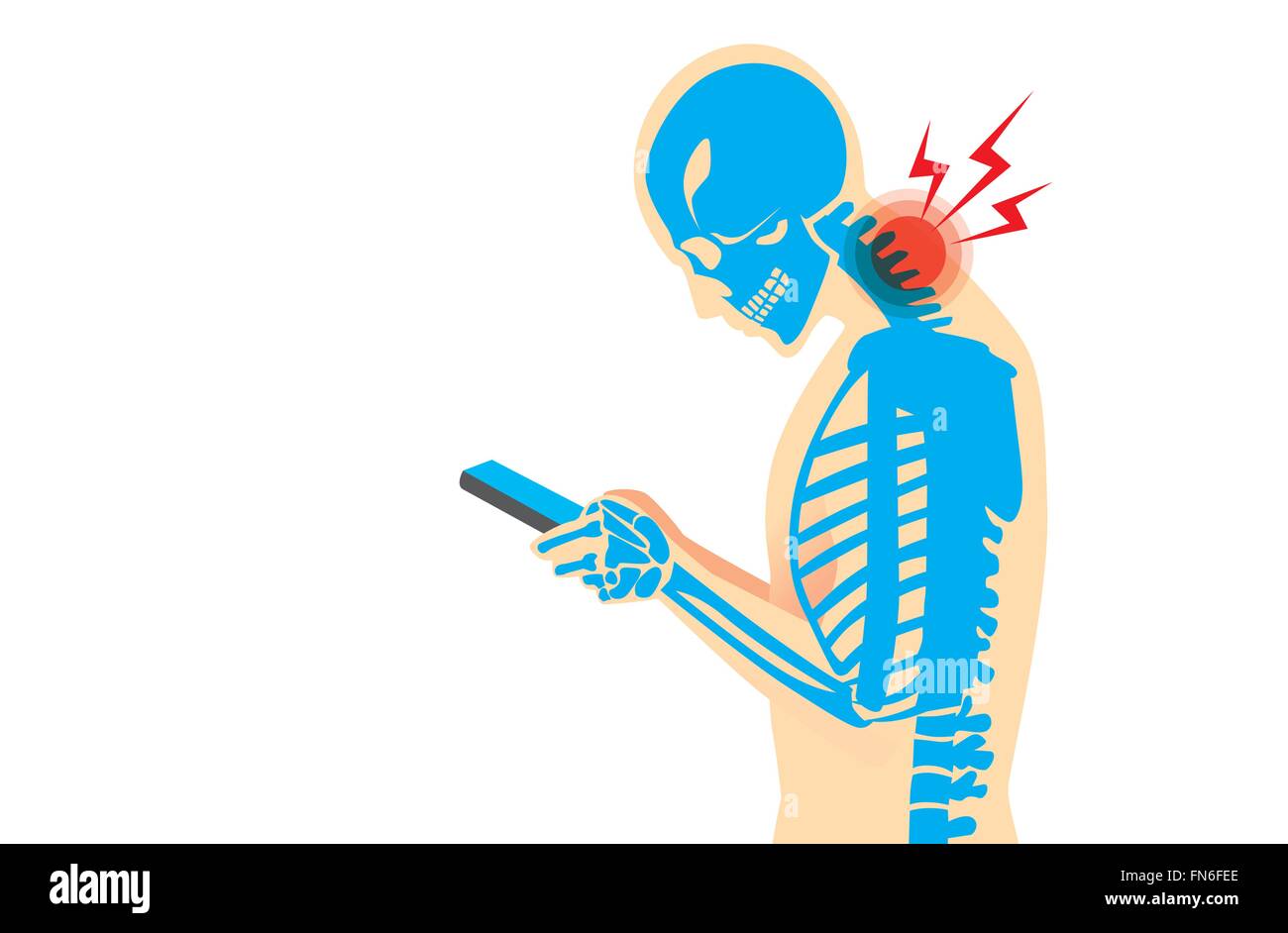Neck Pain from Smart phone Stock Vector Image & Art Alamy