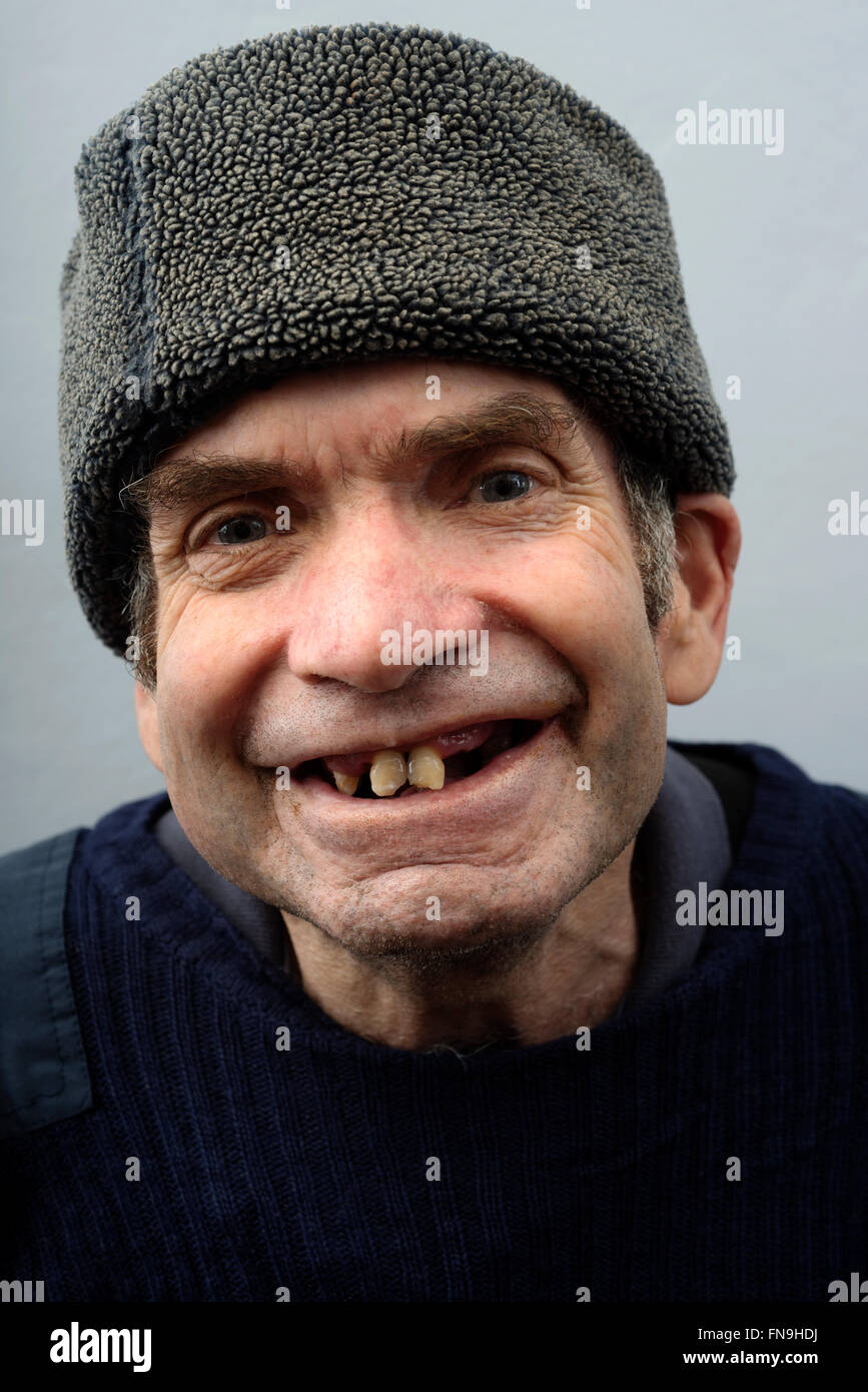 Man with learning difficulties Stock Photo