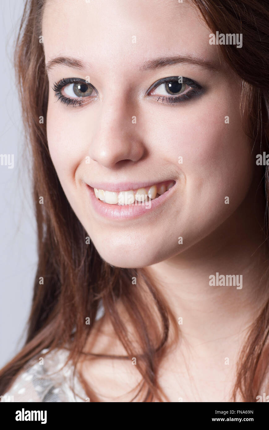 Young woman with Anisocoria and Horner's Syndrome Stock Photo Alamy