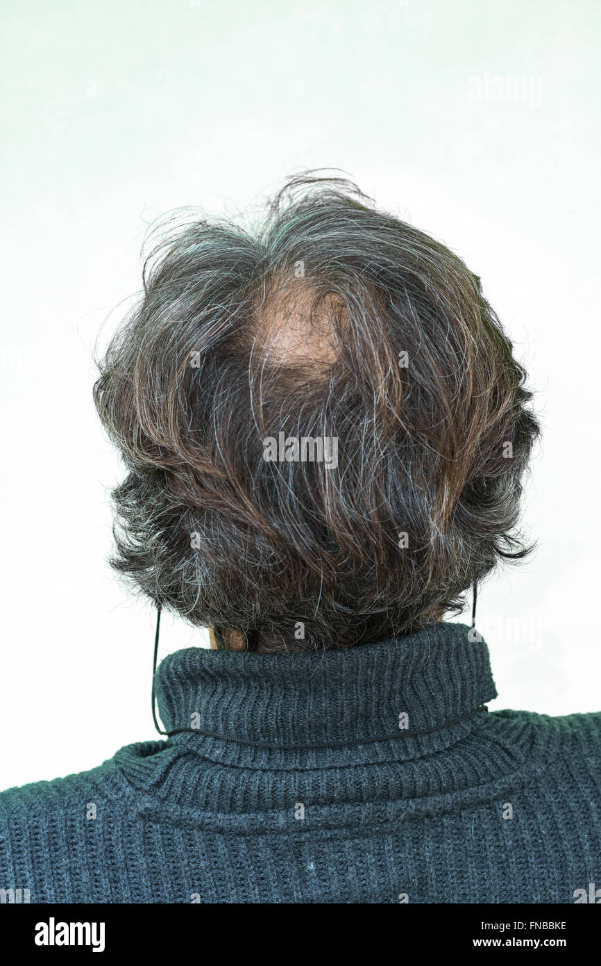 Mature yang man, seen from behind, in the head, begins to lose hair, he begins to be old. Stock Photo